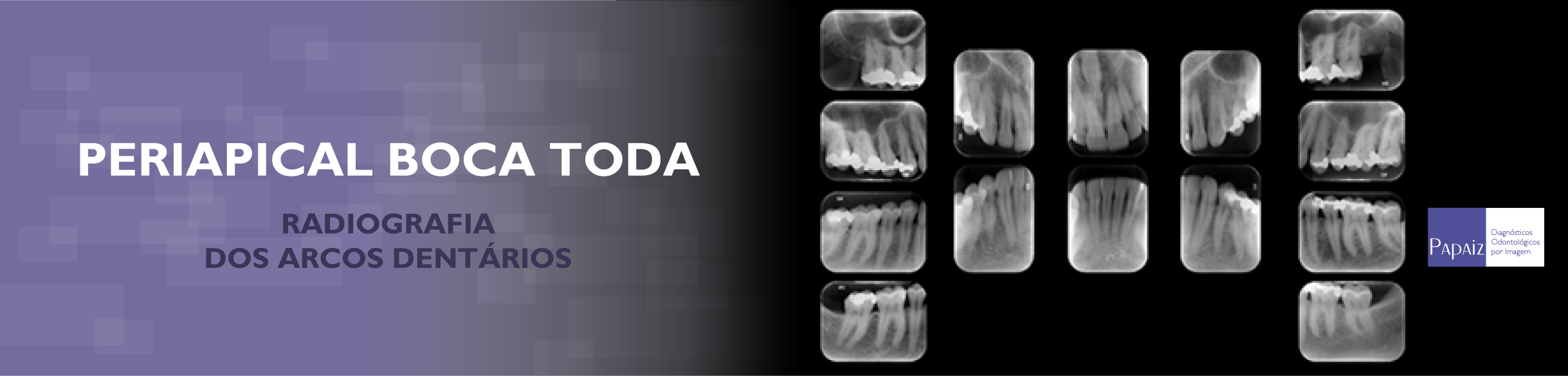 banner_servicos_periapical